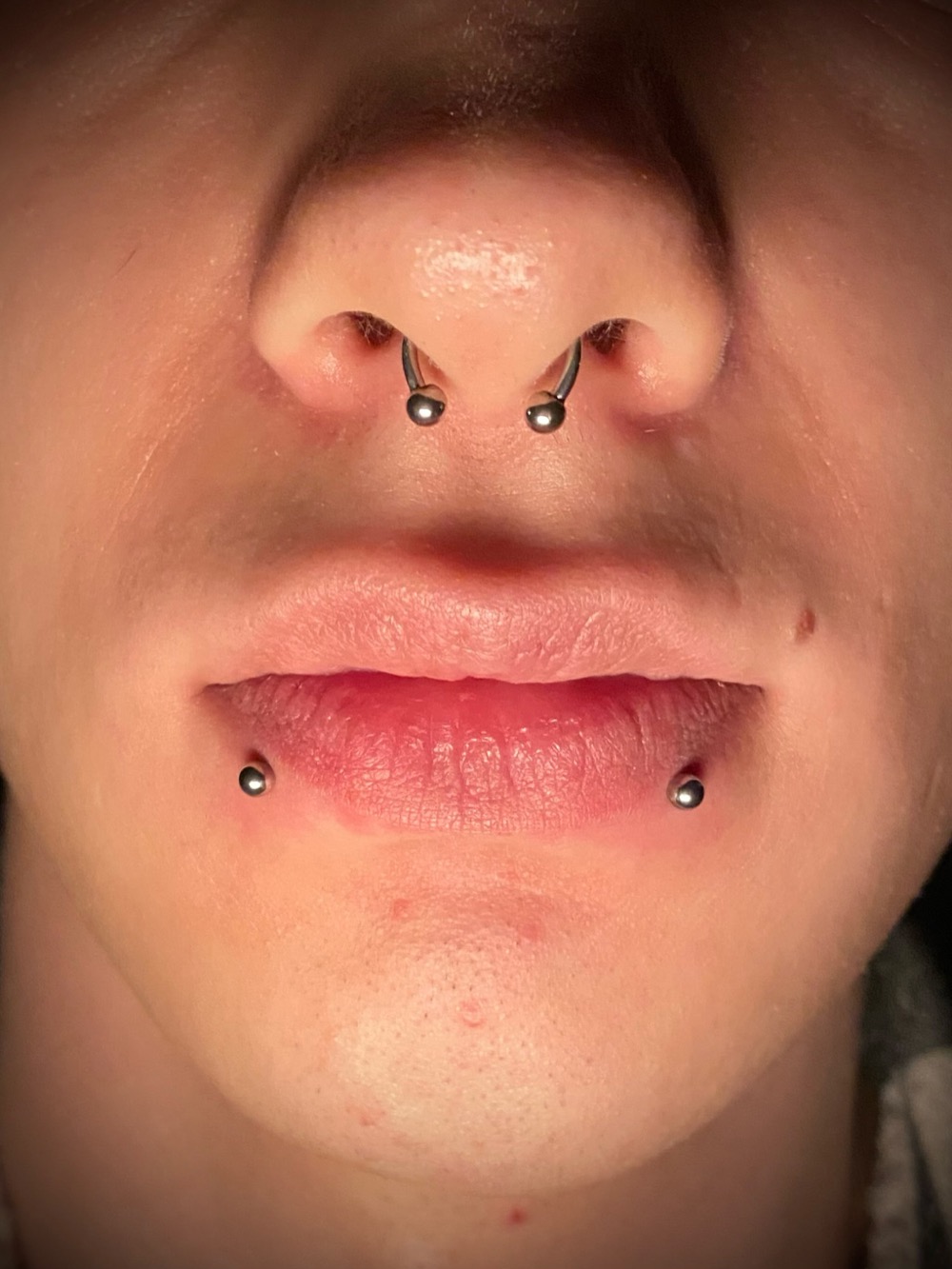 Snake bites and a septum